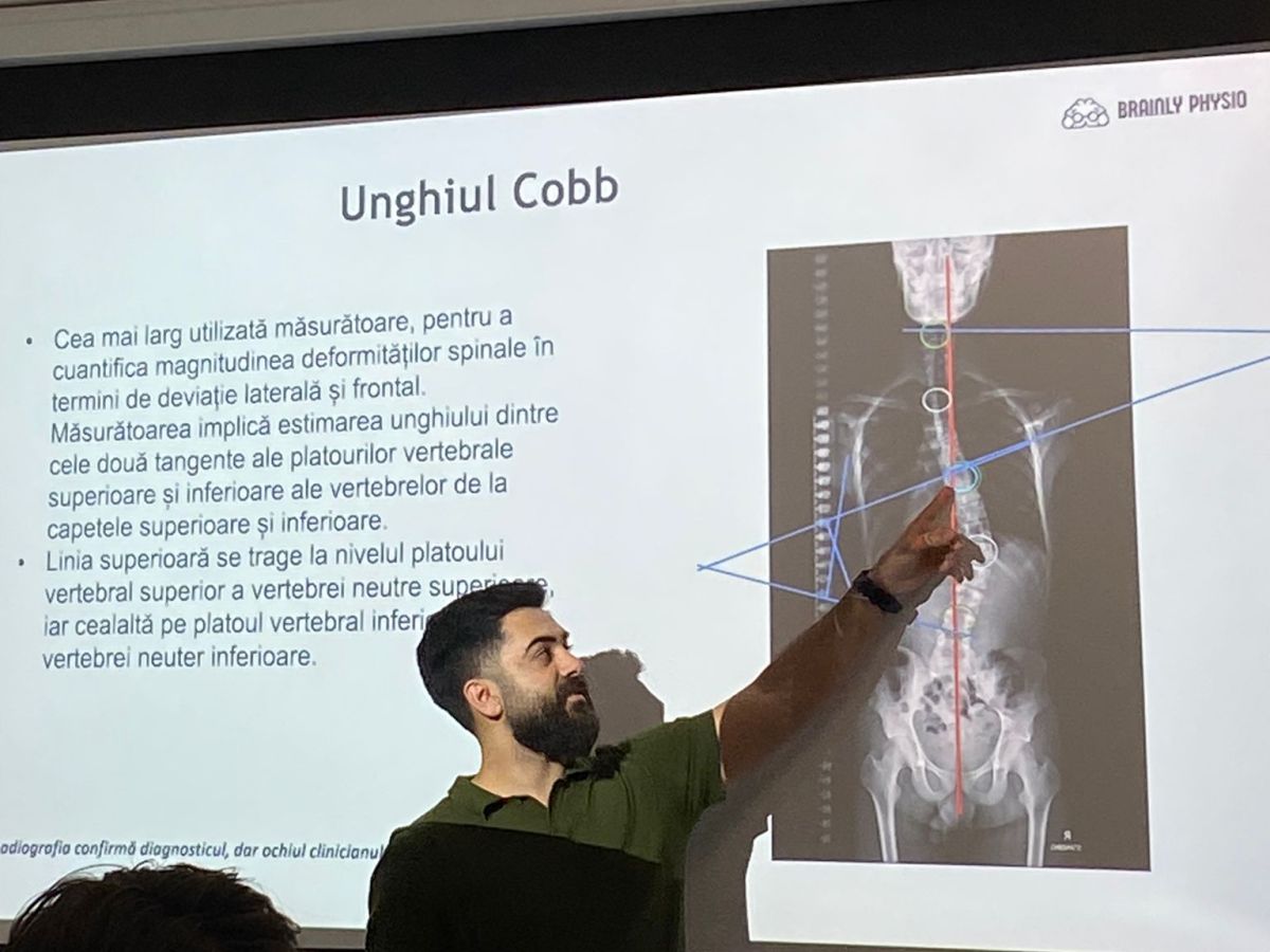 Recap: Brainly Physio Talks #1 – scolioza – 25 noiembrie&nbsp;2025