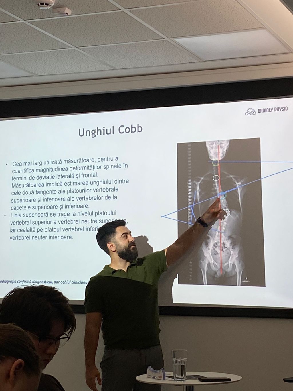 Recap: Brainly Physio Talks #1 – scolioza – 25 noiembrie&nbsp;2025